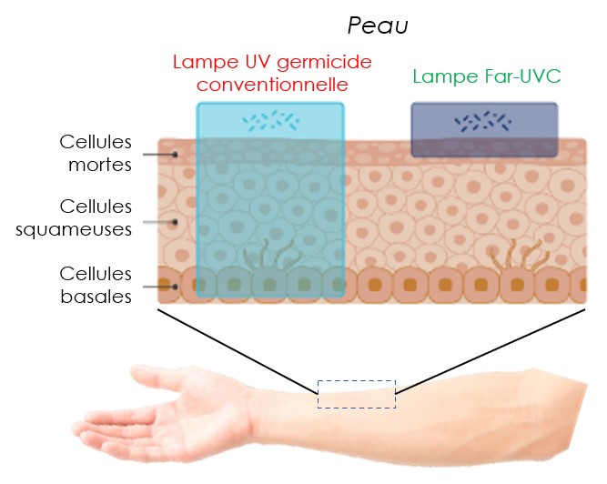 Sécurité FAR-UVC-La peau